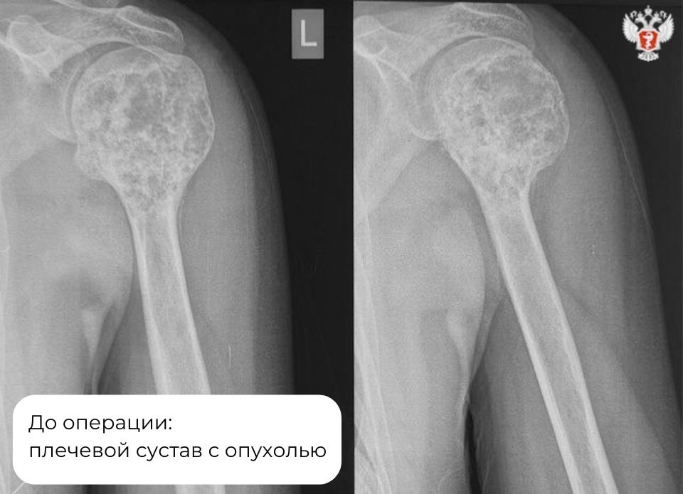 Специалисты НМИЦ травматологии и ортопедии им. Н.Н