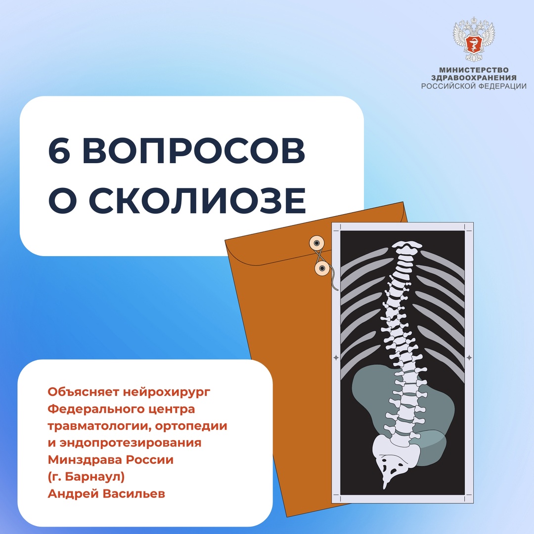 6 вопросов о сколиозе О первых признаках сколиоза и о том, что делать, если обнаружили их у себя, рассказал нейрохирург Федерального центра травматологии,…