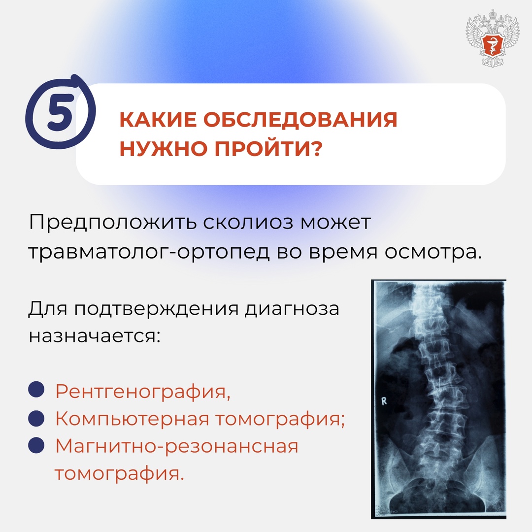 6 вопросов о сколиозе О первых признаках сколиоза и о том, что делать, если обнаружили их у себя, рассказал нейрохирург Федерального центра травматологии,…