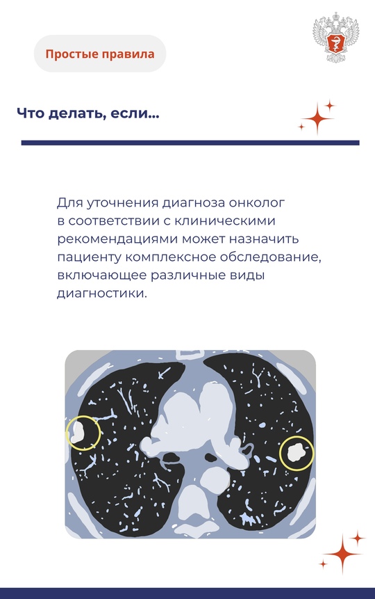 #ПростыеПравила: Лучший способ избежать рака лёгкого — не допускать воздействия на организм факторов риска