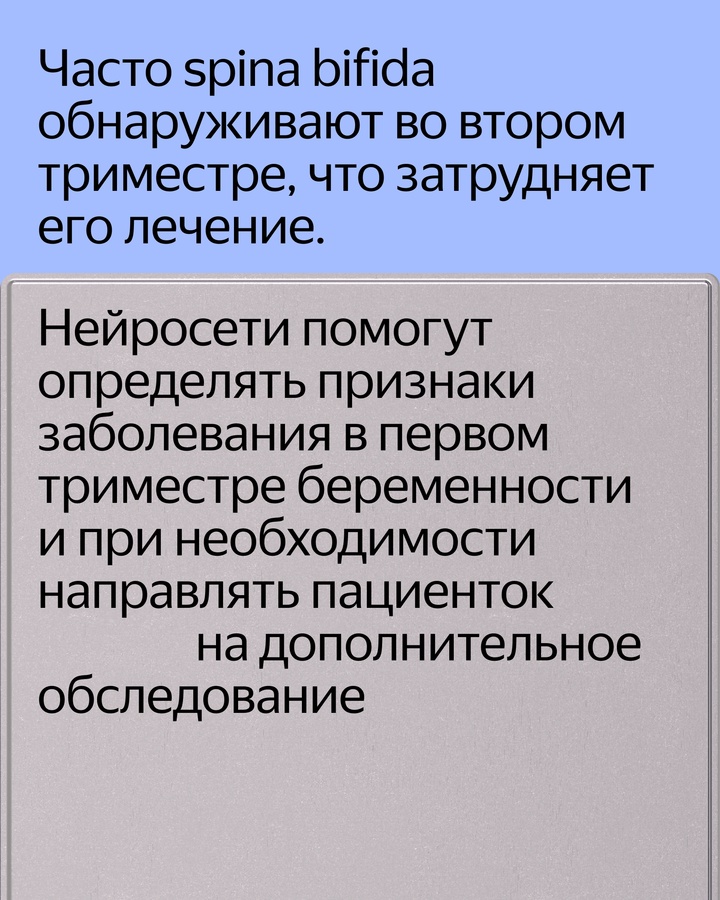 Нейросеть Яндекса поможет врачам выявлять признаки редкого заболевания spina bifida на ранних сроках беременности