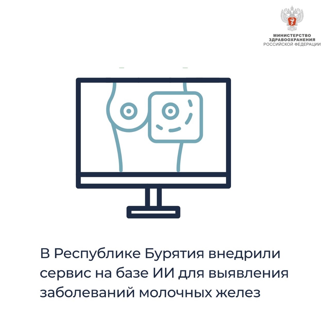 В поликлиниках Республики Бурятия внедрили сервис на базе ИИ для выявления заболеваний молочных желез