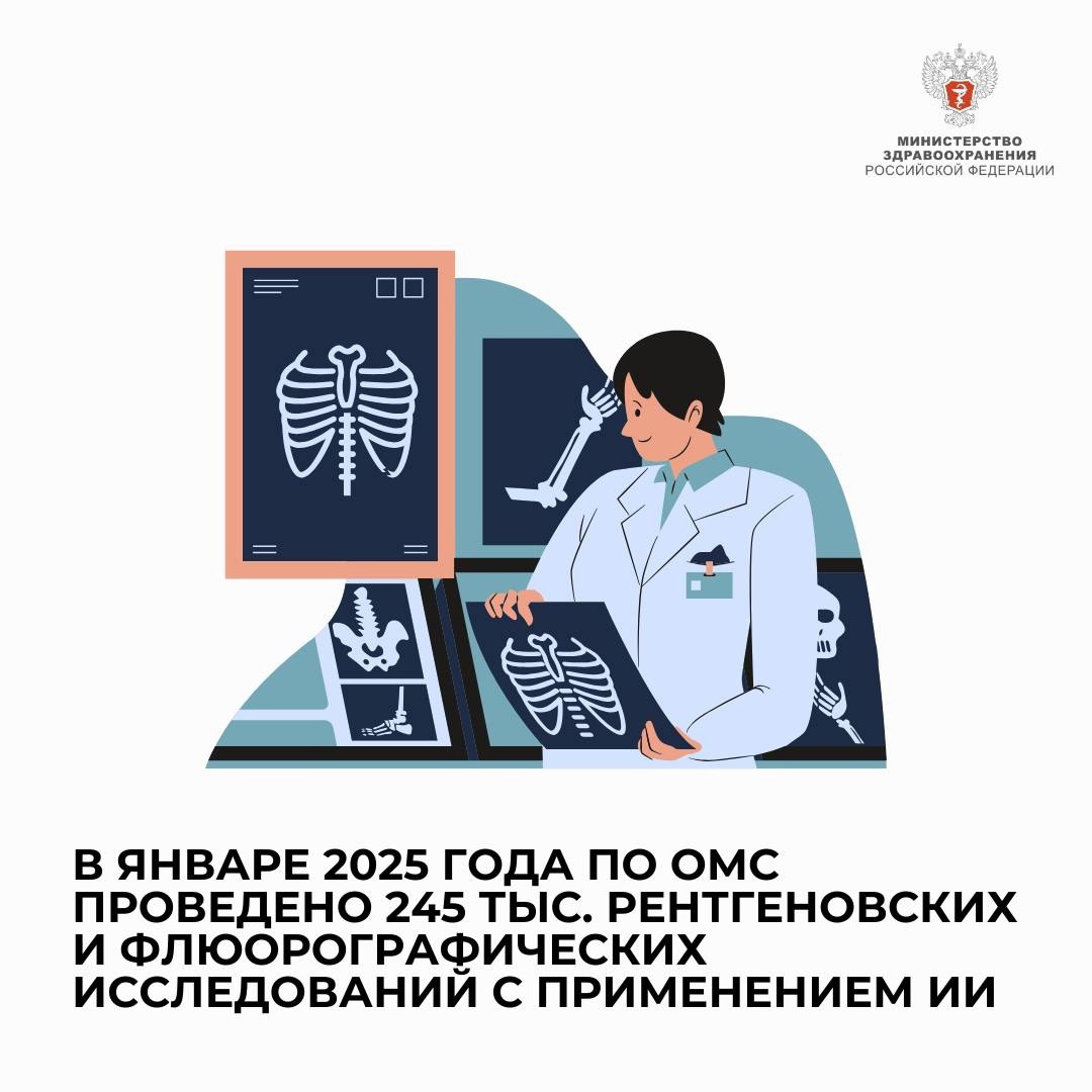 В январе 2025 года по ОМС проведено 245 тыс. рентгеновских и флюорографических исследований с применением ИИ