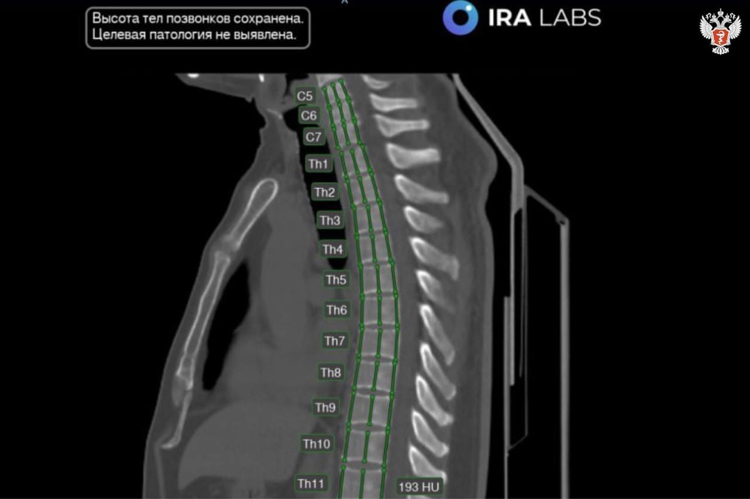 В медучреждениях Калмыкии внедряются сервисы с ИИ для расшифровки исследований