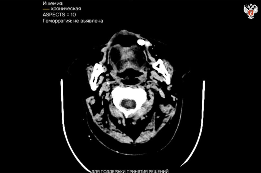 В медучреждениях Калмыкии внедряются сервисы с ИИ для расшифровки исследований