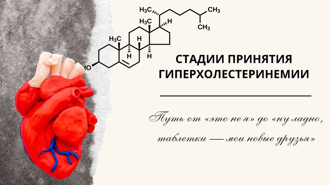 #ПростыеПравила: Стадии принятия гиперхолестеринемии