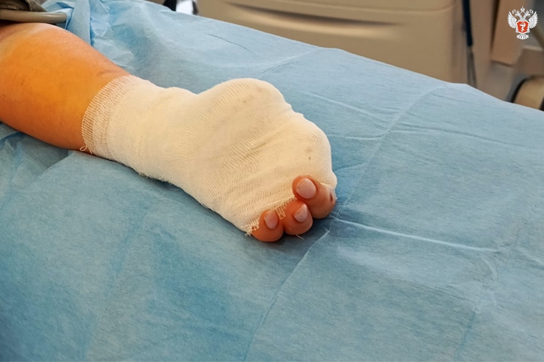 Пальцы пришлось удалить: врачи из Югры спасли девушку с электротравмой из-за зарядки телефона в ванной