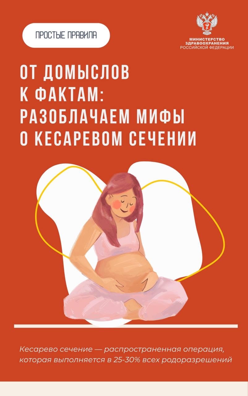 #ПростыеПравила: Мифы и правда о кесаревом сечении