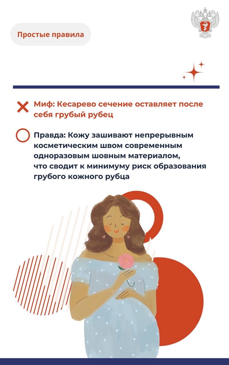 #ПростыеПравила: Мифы и правда о кесаревом сечении