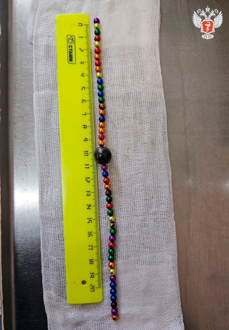 Воронежские врачи спасли ребенка, который проглотил 48 магнитов