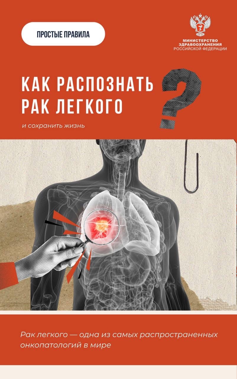 #ПростыеПравила: Как распознать рак легкого