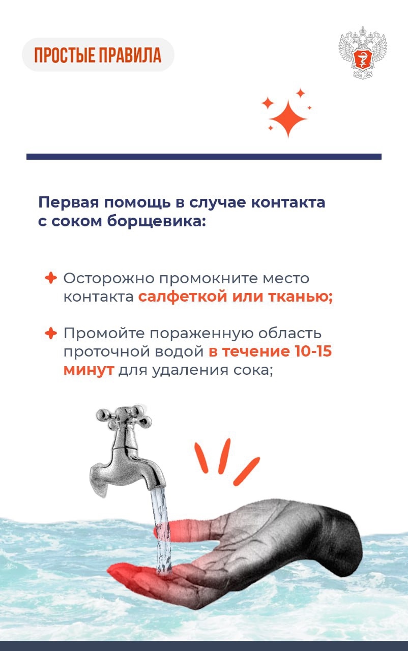 #ПростыеПравила: Что делать при ожоге борщевиком