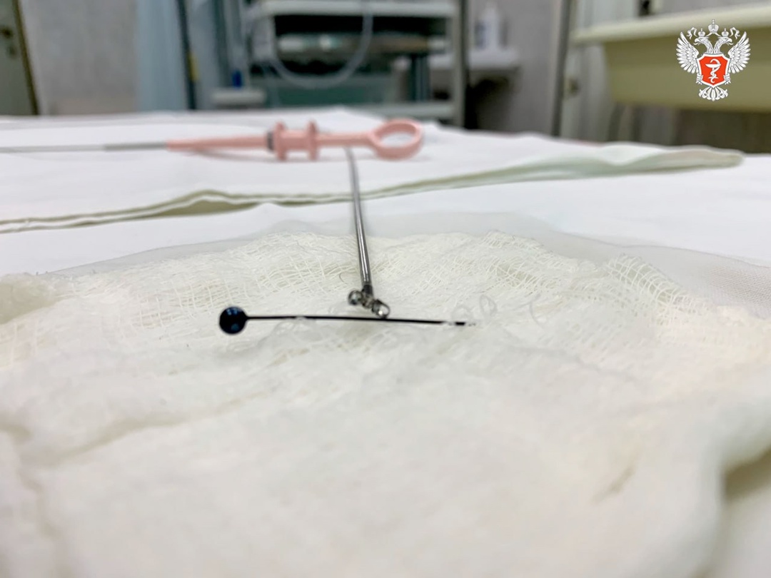 Врачи из Нижнего Тагила спасли мужчину, проглотившего 5-сантиметровую иглу