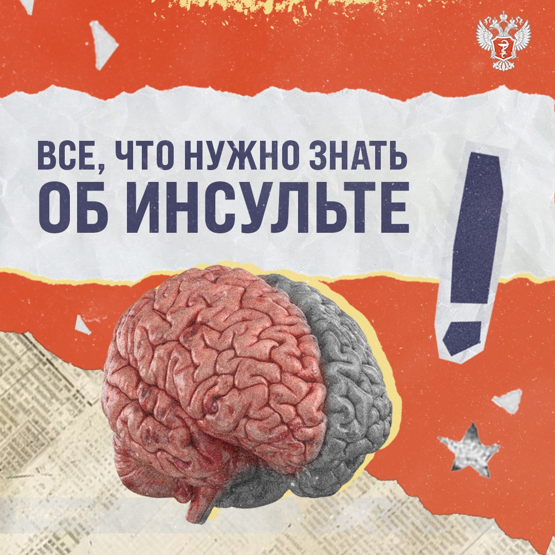 Собрали для вас все, что нужно знать об инсульте — симптомы, профилактика и помощь:
