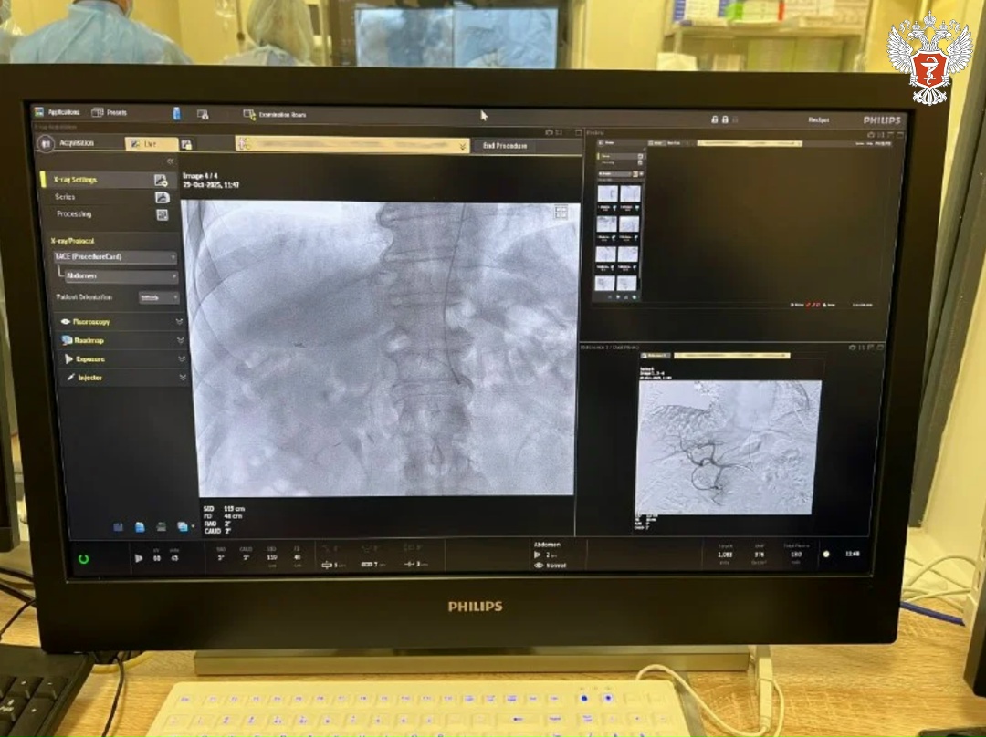 В Онкологическом центре Калининградской области проводят уникальные операции по точечной химиотерапии