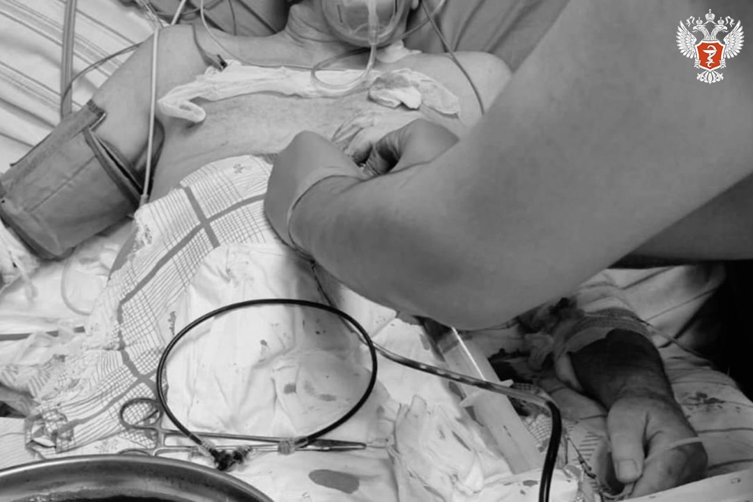 Подмосковные врачи спасли мужчину, у сердца которого скопился литр жидкости