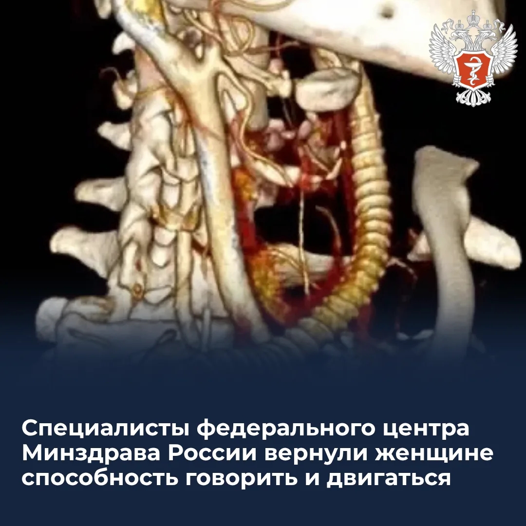 Специалисты федерального центра Минздрава России вернули женщине способность говорить и двигаться