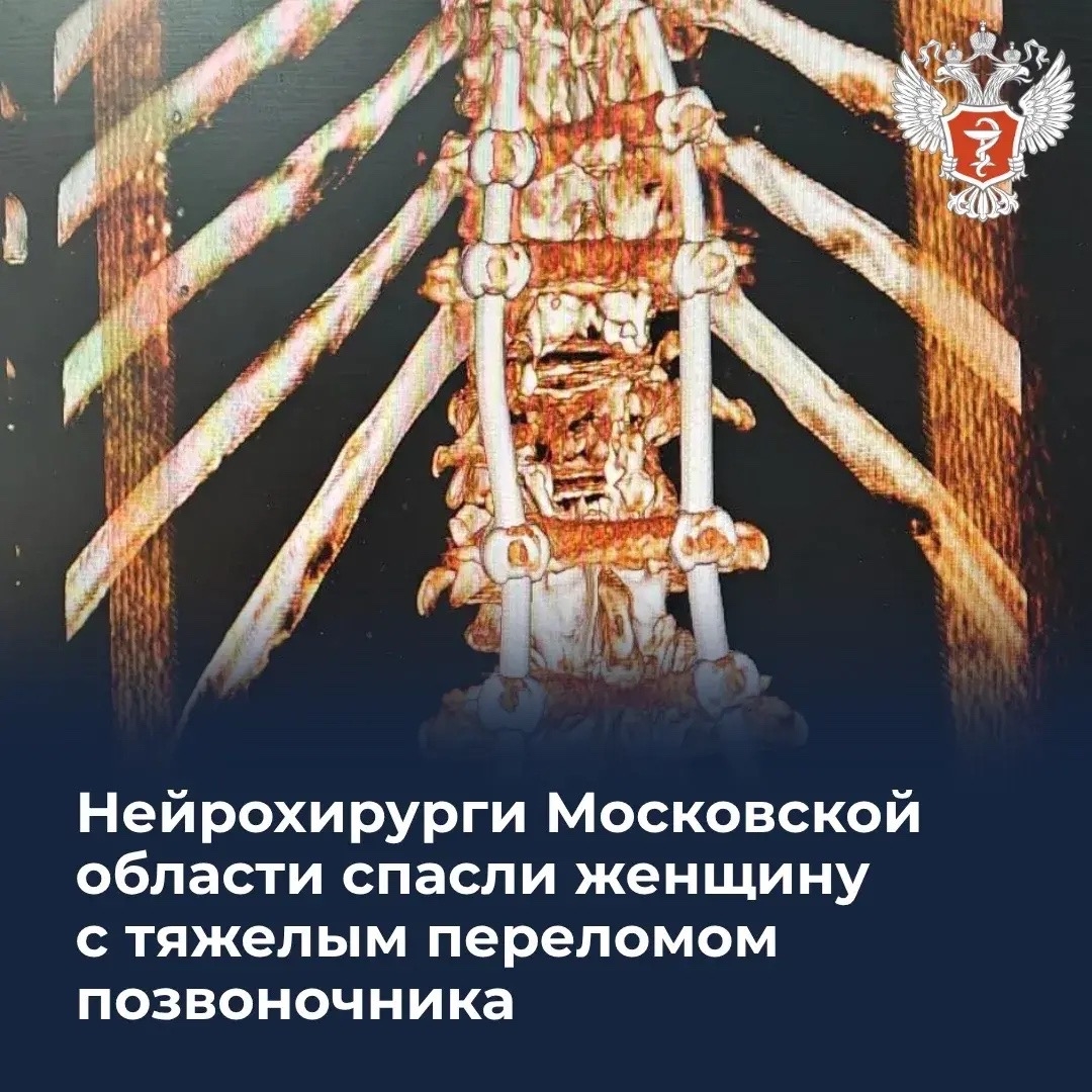 Нейрохирурги Московской области спасли женщину с тяжелым переломом позвоночника