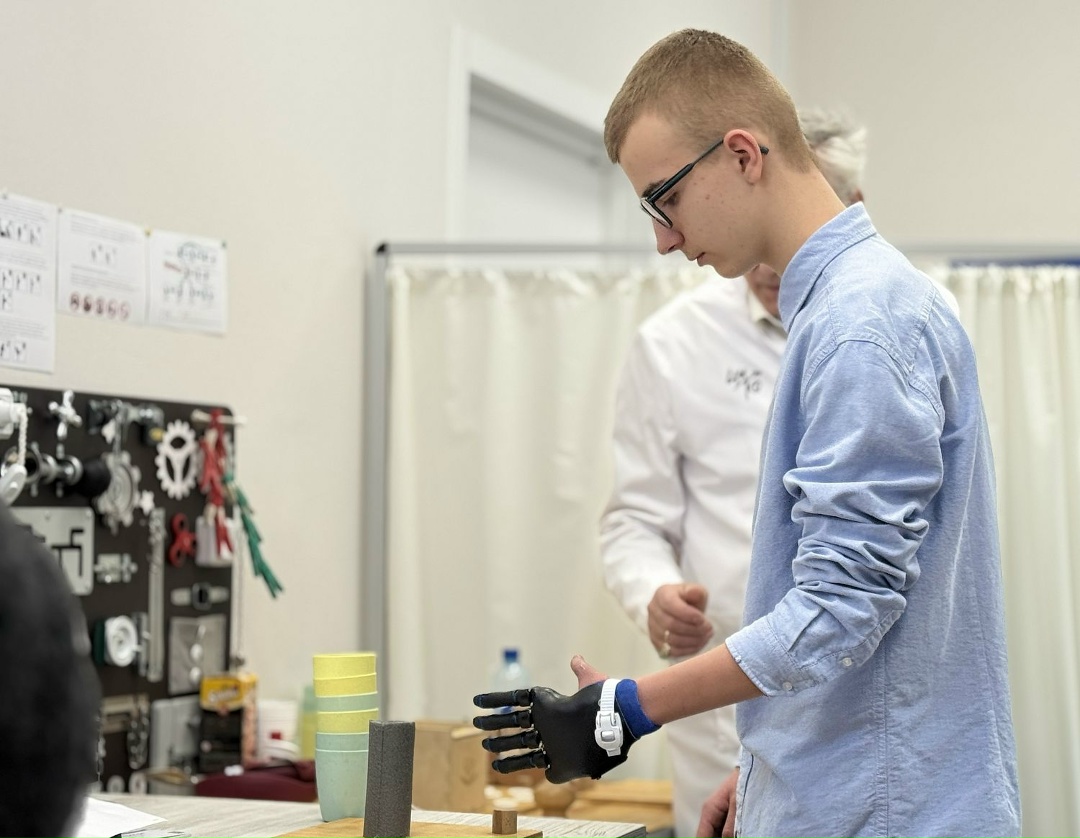 Ростех создал протез для мальчика со сложной аномалией кисти