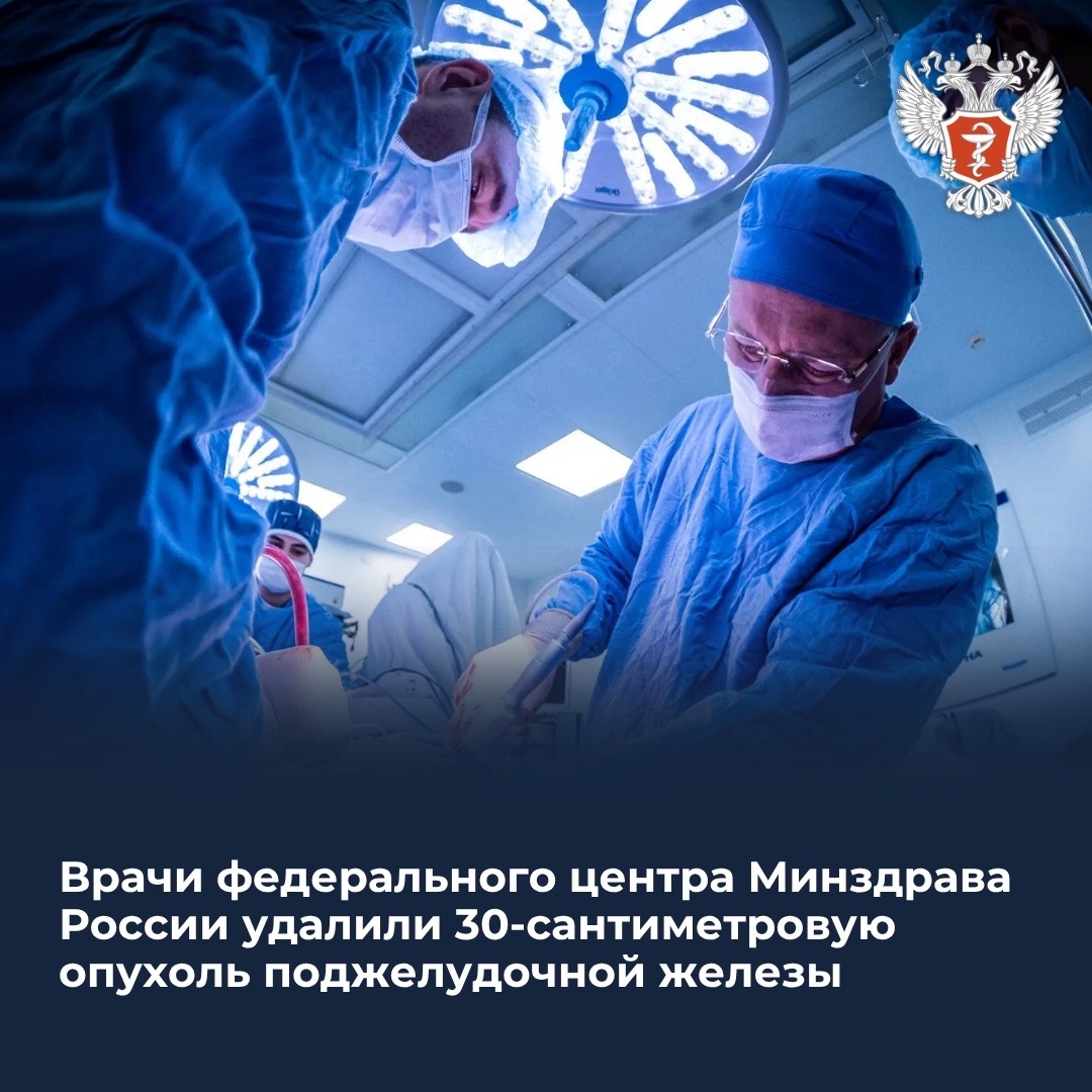 Врачи федерального центра Минздрава России удалили 30-сантиметровую опухоль поджелудочной железы