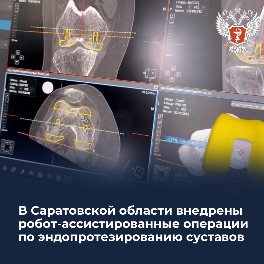 В Саратовской области внедрены робот-ассистированные операции по эндопротезированию суставов