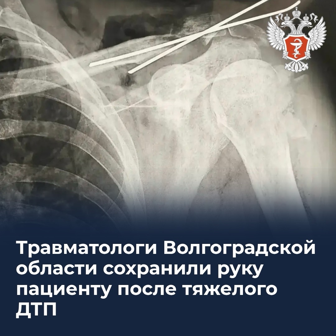 Травматологи Волгоградской области сохранили руку пациенту после тяжелого ДТП