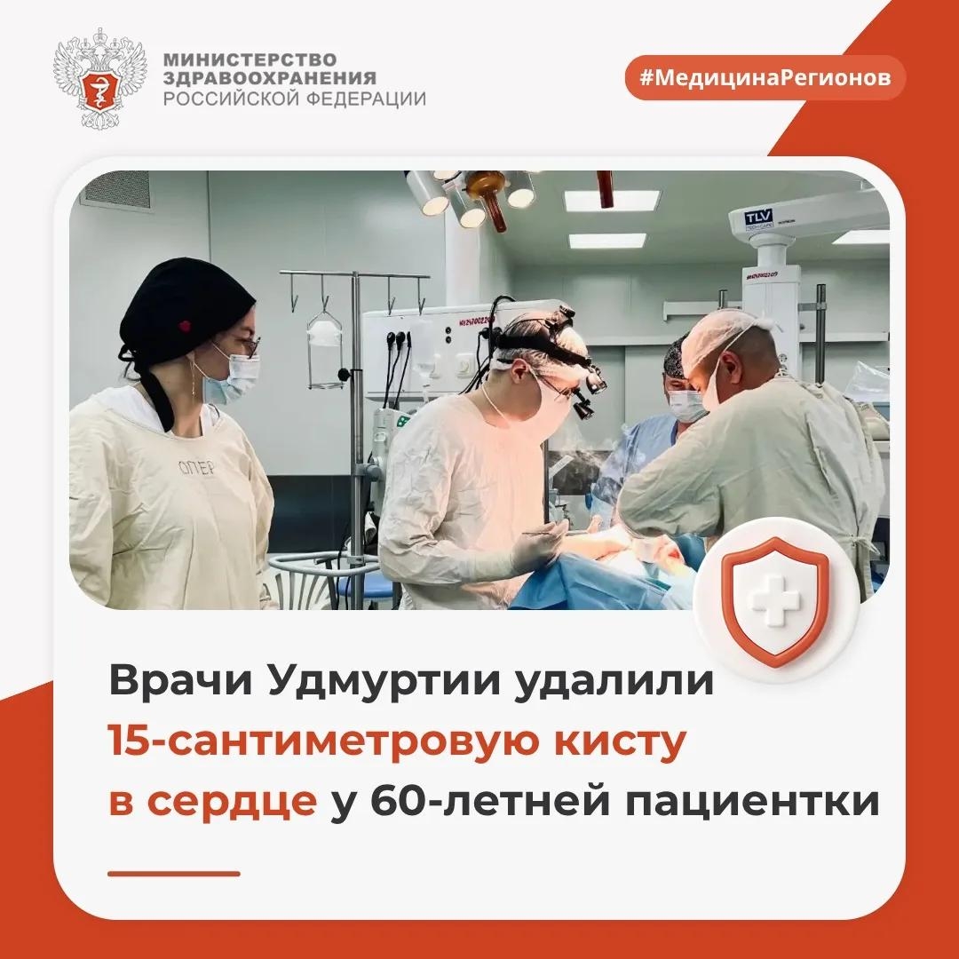 Врачи Удмуртии удалили 15-сантиметровую кисту в сердце у 60-летней пациентки