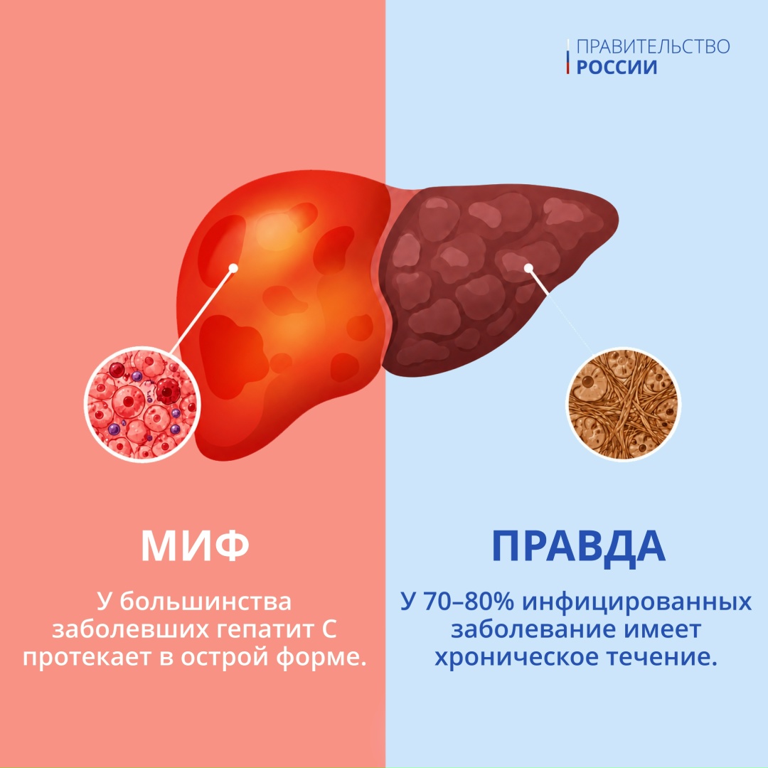 28 июля — Всемирный день борьбы с гепатитом.