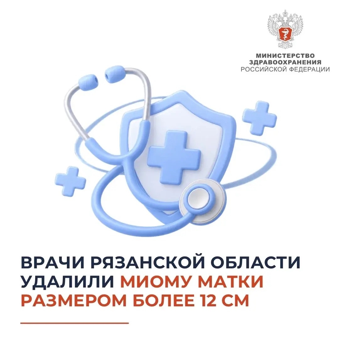 Врачи Рязанской области удалили миому матки размером более 12 см