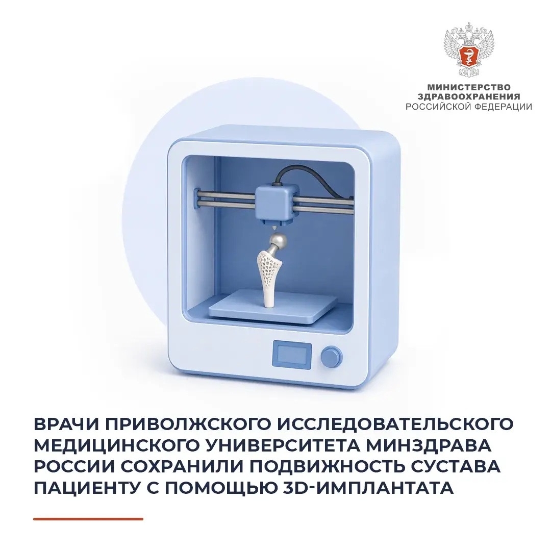 Врачи Приволжского исследовательского медицинского университета Минздрава России сохранили подвижность сустава пациенту с помощью 3D-имплантата