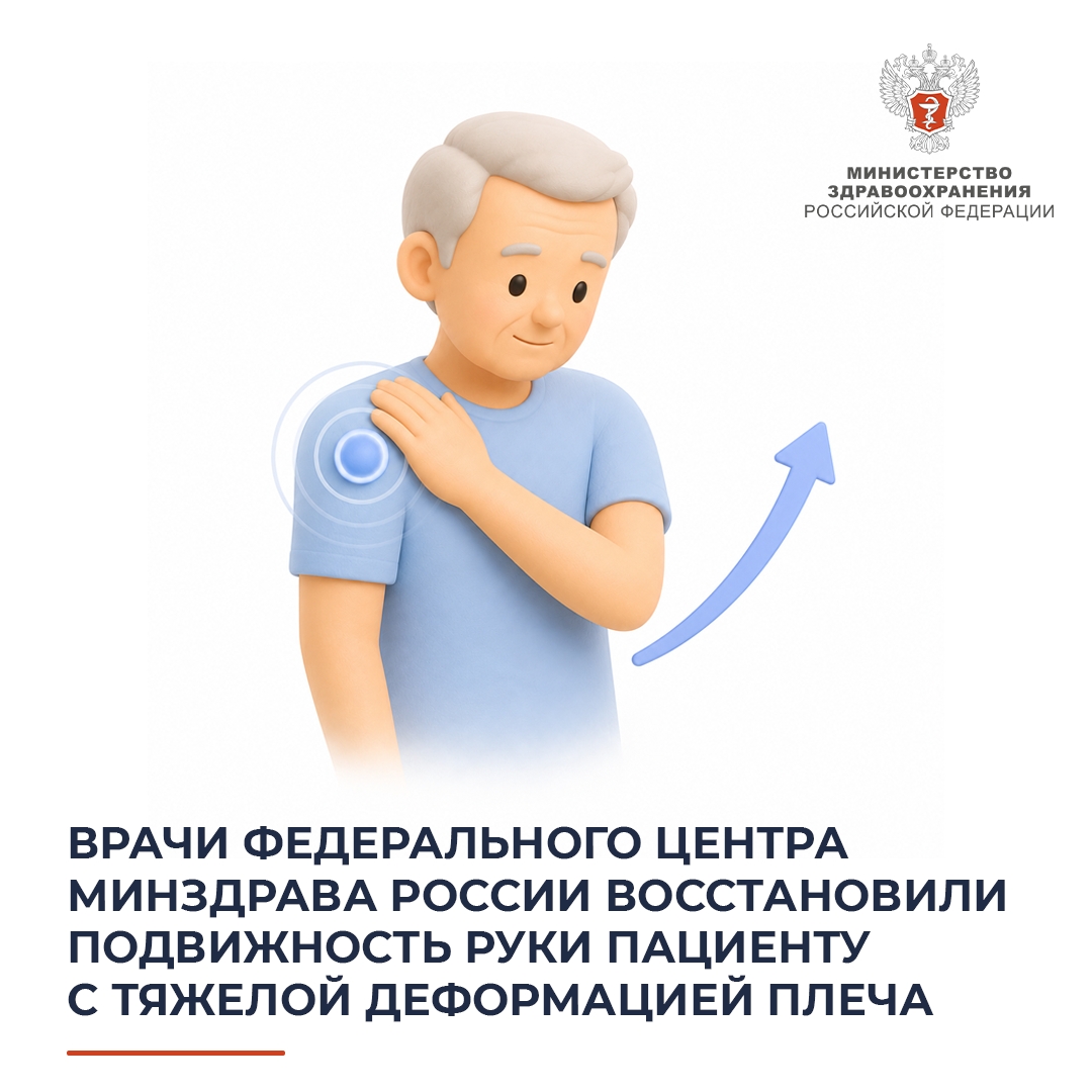 Врачи федерального центра Минздрава России восстановили подвижность руки пациенту с тяжёлой деформацией плеча